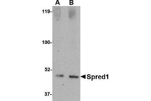 Western Blotting (WB) image for anti-Sprouty-Related, EVH1 Domain Containing 1 (SPRED1) (Middle Region 2) antibody (ABIN1031204) (SPRED1 anticorps  (Middle Region 2))