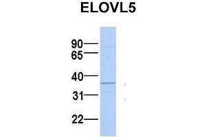 Host:  Rabbit  Target Name:  ELOVL5  Sample Type:  MCF7  Antibody Dilution:  1. (ELOVL5 anticorps  (N-Term))