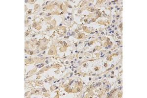 Immunohistochemistry of paraffin-embedded human stomach using TOLLIP antibody at dilution of 1:200 (x400 lens) (TOLLIP anticorps  (AA 1-274))