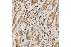 Immunohistochemistry of paraffin-embedded human stomach using MDM2 antibody at dilution of 1:200 (x400 lens).