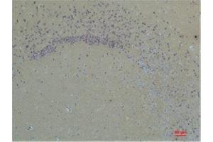 Immunohistochemistry (IHC) analysis of paraffin-embedded Rat Brain Tissue using Glutamate Receptor 1 Rabbit Polyclonal Antibody diluted at 1:200. (Glutamate Receptor 1 anticorps)