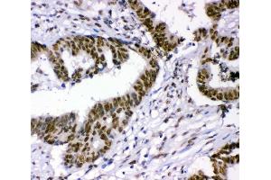 IHC analysis of p95 NBS1 using anti-p95 NBS1 antibody (ABIN3043282). (Nibrin anticorps  (C-Term))