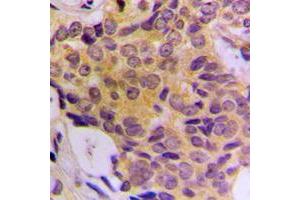 anti-CDK5 Regulatory Subunit Associated Protein 3 (CDK5RAP3) (Center) antibody