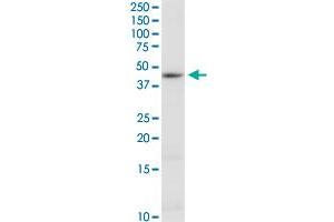 CTH monoclonal antibody (M03), clone S51.