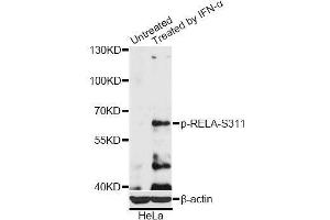 Western blot analysis of extracts of HeLa cells, using Phospho-RELA-S311 antibody (ABIN5969962) at 1/2000 dilution. (NF-kB p65 anticorps  (pSer311))