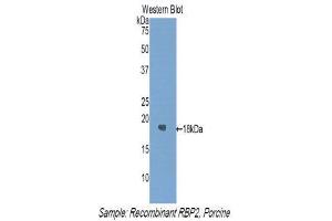 Western Blotting (WB) image for anti-Retinol Binding Protein 2, Cellular (RBP2) (AA 1-134) antibody (ABIN1860412) (RBP2 anticorps  (AA 1-134))