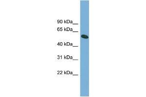 WB Suggested Anti-OMA1 Antibody Titration: 0. (OMA1 anticorps  (Middle Region))