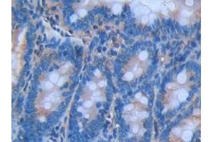 Detection of IL6 in Rat Small Intestine Tissue using Monoclonal Antibody to Interleukin 6 (IL6)