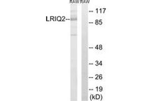 Western blot analysis of extracts from RAW264. (CEP97 anticorps  (AA 581-630))