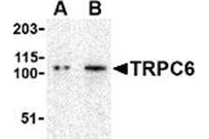 Western blot analysis of TRPC6 in K562 cell lysate with this product at (A) 0. (TRPC6 anticorps  (N-Term))