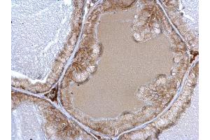 IHC-P Image alpha 1a Adrenergic Receptor antibody detects alpha 1a Adrenergic Receptor protein at cytosol on mouse prostate by immunohistochemical analysis. (alpha 1 Adrenergic Receptor anticorps)