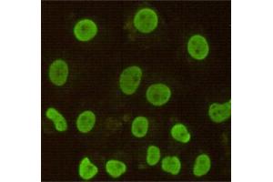 Immunocytochemistry stain of Hela using CDX2 mouse mAb (1:100). (CDX2 anticorps)