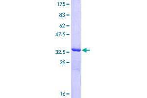 Image no. 1 for Caspase Recruitment Domain Family, Member 16 (CARD16) (AA 1-97) protein (GST tag) (ABIN1348045)