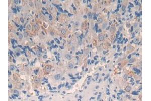 DAB staining on IHC-P; Samples: Mouse Ovary Tissue