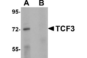 Western Blotting (WB) image for anti-Transcription Factor 3 (E2A Immunoglobulin Enhancer Binding Factors E12/E47) (TCF3) (N-Term) antibody (ABIN1031605) (TCF3 anticorps  (N-Term))