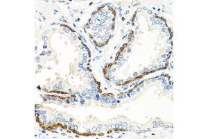 Immunohistochemistry of paraffin-embedded human prostate using BMP5 antibody.