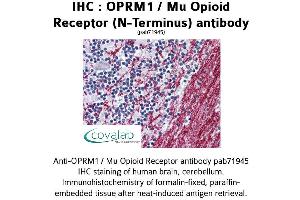 Image no. 1 for anti-Opioid Receptor, mu 1 (OPRM1) (N-Term) antibody (ABIN1737658) (Mu Opioid Receptor 1 anticorps  (N-Term))