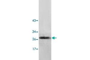 Western blot analysis of human fetal brain lysate with NUDT7 polyclonal antibody  at 1 : 500 dilution. (NUDT7 anticorps  (AA 2-236))