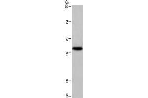 Western Blotting (WB) image for anti-Potassium Voltage-Gated Channel, Subfamily G, Member 4 (Kcng4) antibody (ABIN2433243) (KCNG4 anticorps)