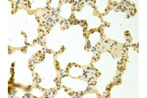 Immunohistochemistry of paraffin-embedded rat lung using HNRNPK Antibody.