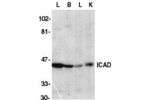 Western blot analysis of ICAD in mouse lung (L), brain (B), liver (L), and kidney tissue lysate with AP30399PU-N CAD antibody at 1/1000 dilution. (DFFA anticorps  (C-Term))