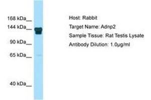 ADNP2 antibody  (N-Term)