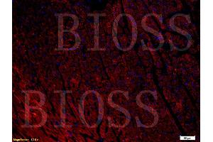 Formalin-fixed and paraffin-embedded rat heart labeled with Anti-NPY1R Polyclonal Antibody, Unconjugated (ABIN737211) 1:400, overnight at 4°C, The secondary antibody was Goat Anti-Rabbit IgG, PE conjugated used at 1:200 dilution for 40 minutes at 37°C.