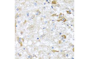 Immunohistochemistry of paraffin-embedded rat brain using ABCB8 antibody. (ABCB8 anticorps)