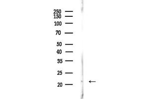 anti-Glucuronidase, beta Pseudogene 2 (GUSBP2) (Internal Region) antibody
