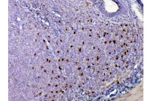 IHC analysis of IL33 using anti-IL33 antibody .