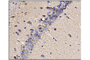 IHC analysis of Dynamin 3/DNM3 using anti-Dynamin 3/DNM3 antibody (ABIN7601163). (Dynamin 3 anticorps  (AA 295-712))