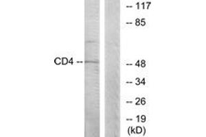 Western blot analysis of extracts from COLO205 cells, using CD4 (Ab-433) Antibody. (CD4 anticorps  (AA 401-450))