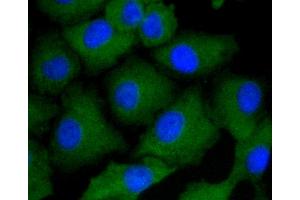 Immunofluorescence analysis of A549 cells using ARRB1 antibody (ABIN5996907). (beta Arrestin 1 anticorps)