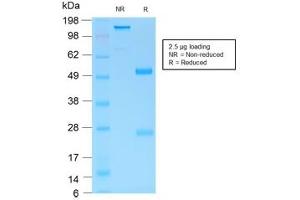 SDS-PAGE analysis of purified, BSA-free recombinant Gastric Mucin antibody (clone MUC6/1553R) as confirmation of integrity and purity. (MUC6 anticorps)