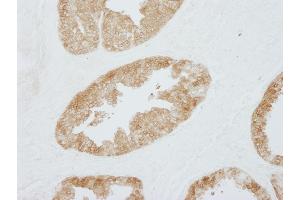 Immunohistochemistry (IHC) image for anti-Stratifin (SFN) (AA 198-248) antibody (ABIN7448925)