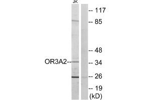 Western blot analysis of extracts from Jurkat cells, using OR3A2 antibody. (OR3A2 anticorps  (C-Term))