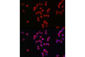 Immunofluorescence analysis of Neuro-2a cells using GRIN2B Rabbit pAb (ABIN3017275, ABIN3017276, ABIN3017277 and ABIN1680110) at dilution of 1:100 (40x lens).