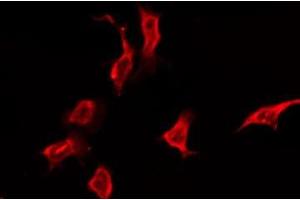 ABIN6276171 staining Hela by IF/ICC. (OR5K3 anticorps  (Internal Region))