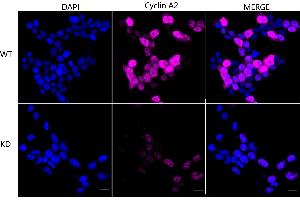 Immunocytochemical staining of HeLa cells using Cyclin A2 antibody (ABIN7798186), 1:1,000), Top panel: wild-type (WT), Bottom panal: Cyclin A2 shRNA knockdown (KD).
