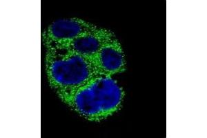 Confocal immunofluorescent analysis of AMACR antibody with HepG2 cells followed by Alexa Fluor 488-conjugated goat anti-rabbit lgG (green).