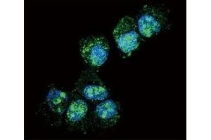 Confocal immunofluorescent analysis of PGP9.