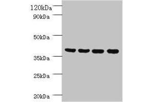Western blot All lanes: Prootein FAM110B antibody at 2 μg/mL Lane 1: Mouse sexual gland tissue Lane 2: HepG2 whole cell lysate Lane 3: Mouse spleen tissue Lane 4: A431 whole cell lysate Secondary Goat polyclonal to rabbit IgG at 1/10000 dilution Predicted band size: 41 kDa Observed band size: 41 kDa (TMEM185B anticorps  (AA 1-370))