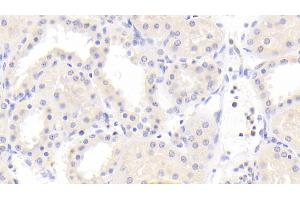 Detection of PCK2 in Human Kidney Tissue using Polyclonal Antibody to Phosphoenolpyruvate Carboxykinase 2, Mitochondrial (PCK2) (PEPCK anticorps  (AA 33-198))