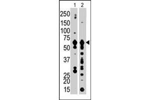The PFKFB3 polyclonal antibody  is used in Western blot to detect PFKFB3 in Jurkat cell lysate (Lane 1) and mouse brain tissue lysate (Lane 2) . (PFKFB3 anticorps  (C-Term))