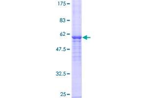 Image no. 1 for N-Acetyltransferase 2 (Arylamine N-Acetyltransferase) (NAT2) (AA 1-290) protein (GST tag) (ABIN1312013)