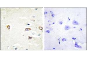 Immunohistochemistry analysis of paraffin-embedded human brain tissue, using MRCKB Antibody. (CDC42BPB anticorps  (AA 1641-1690))