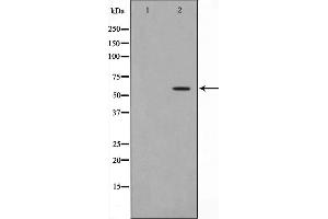 Western blot analysis on HeLa cell lysate using Dyskerin Antibody,The lane on the left is treated with the antigen-specific peptide. (DKC1 anticorps  (Internal Region))