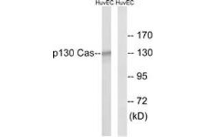Western blot analysis of extracts from HuvEc cells, using p130 Cas (Ab-410) Antibody. (BCAR1 anticorps  (AA 376-425))
