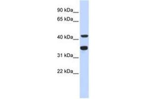 anti-Polymerase (DNA Directed), delta 2, Accessory Subunit (POLD2) (AA 143-192) antibody