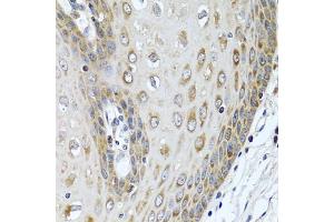 Immunohistochemistry of paraffin-embedded human esophagus using LRG1 antibody (ABIN5975207) at dilution of 1/100 (40x lens). (LRG1 anticorps)